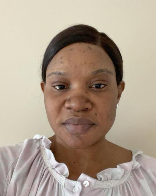 ESTHER BECHEM A.