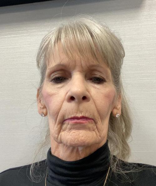 TRESA ANN F.