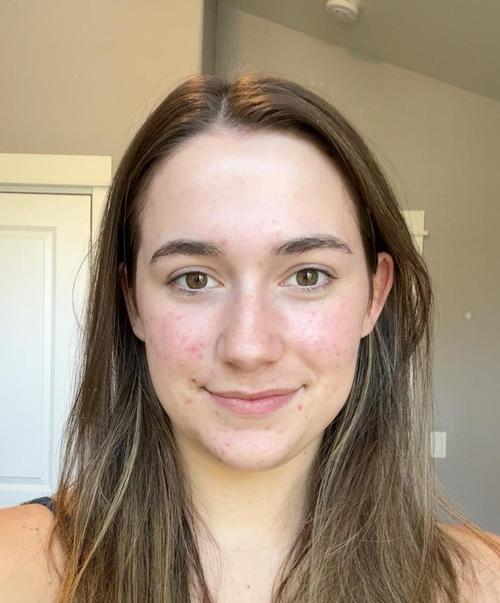 ADALYNN ELISSE R.